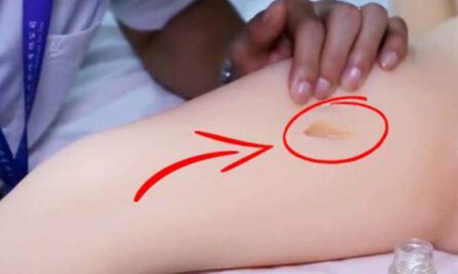 Repair minor damage to sex doll glue