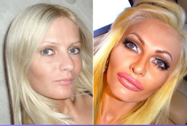 a-latvia-woman-plastic-surgery-just-to-look-like-a-sex-doll-2